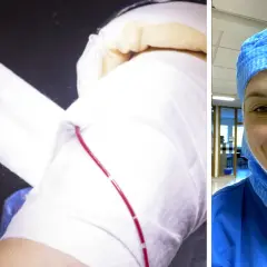 En person i blå operationskläder och skyddshuva ler mot kameran. Till vänster syns en arm som bandageras, en del av en ortoped utbildning.