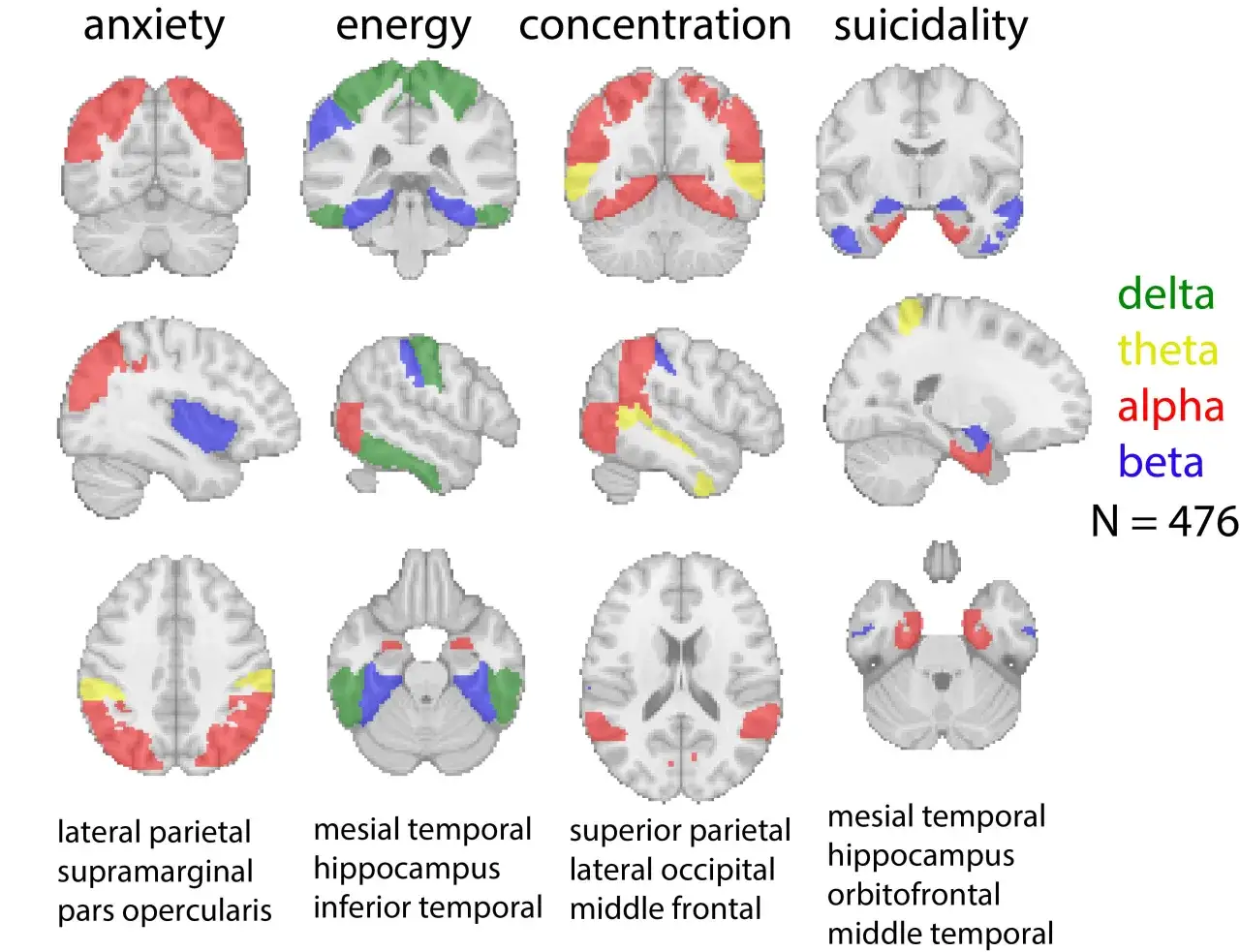 Hj&auml;rnavbildningar visar omr&aring;den kopplade till &aring;ngest, energi, koncentration och suicidialitet, relevant f&ouml;r neurovetenskap utbildning.